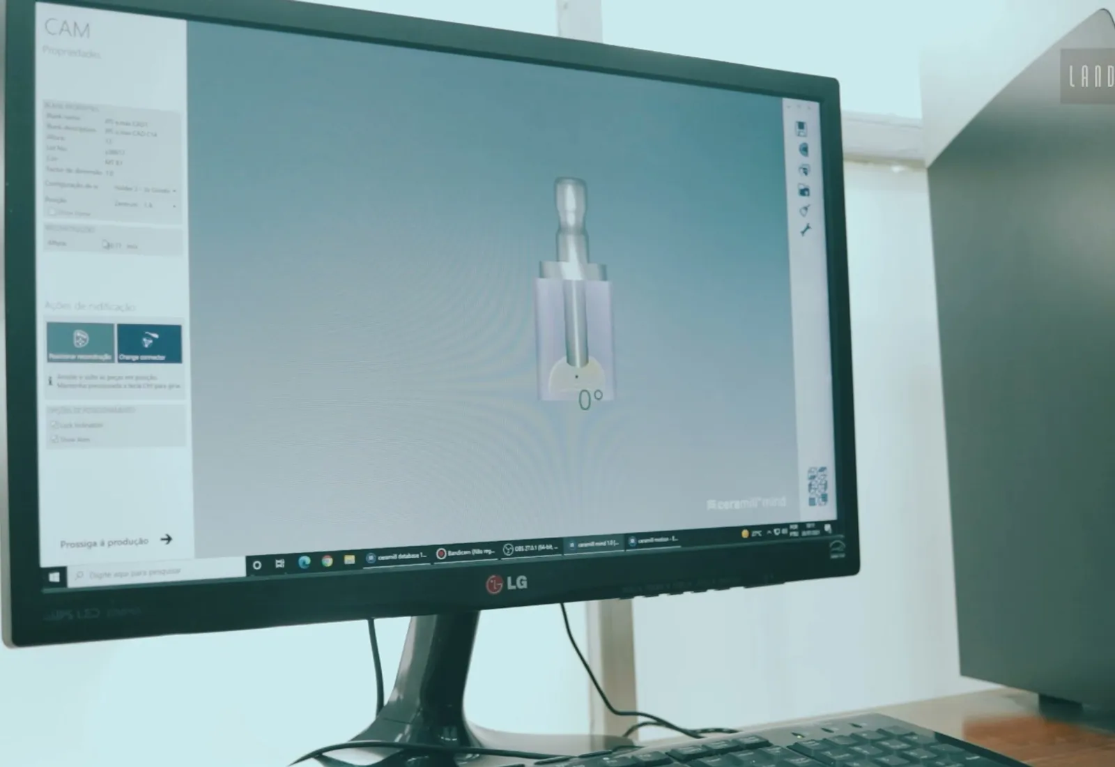 Planejamento digital de componente de implante em software 3D — implantes dentários em Palmas/TO